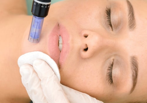 The Benefits of Collagen Treatment: A Comprehensive Guide
